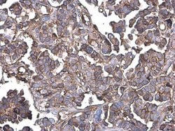 Invitrogen GNB4 Polyclonal Antibody 100 &mu;L; Unconjugated:Antibodies,