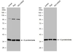 Invitrogen GNB4 Polyclonal Antibody 100 &mu;L; Unconjugated:Antibodies,