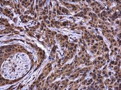 Invitrogen ATG101 Polyclonal Antibody 100 &mu;L; Unconjugated:Antibodies,
