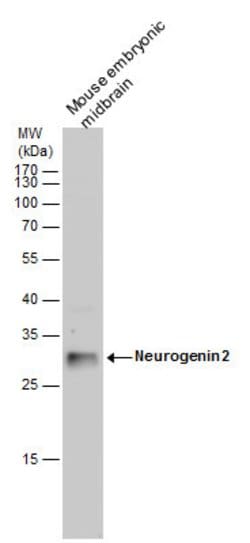 Invitrogen Neurogenin 2 Polyclonal Antibody 100 &mu;L | Buy Online | Invitrogen&trade; | Fisher Scientific