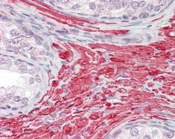 Invitrogen GREM2 Polyclonal Antibody 100 &mu;L; Unconjugated:Antibodies,