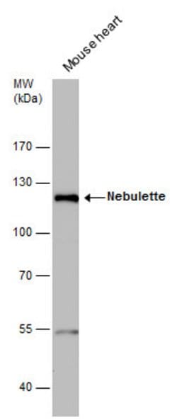 Invitrogen NEBL Polyclonal Antibody 100 &mu;L | Buy Online | Invitrogen&trade; | Fisher Scientific