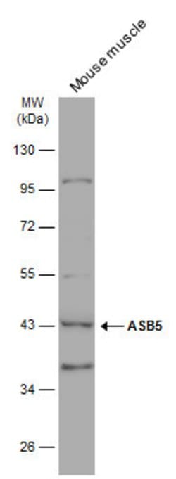 Invitrogen ASB5 Polyclonal Antibody 100 &mu;L; Unconjugated:Antibodies,