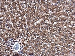 Invitrogen SMPD4 Polyclonal Antibody 100 &mu;L; Unconjugated:Antibodies,