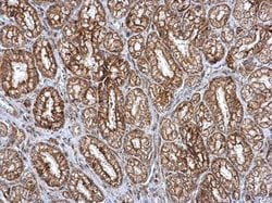 Invitrogen SMPD4 Polyclonal Antibody 100 &mu;L; Unconjugated:Antibodies,