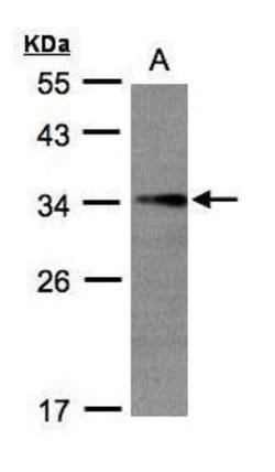 Invitrogen EFHD2 Polyclonal Antibody 100 &mu;L; Unconjugated:Antibodies,