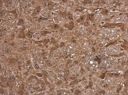 Invitrogen FSD1 Polyclonal Antibody 100 &mu;L | Buy Online | Invitrogen&trade; | Fisher Scientific