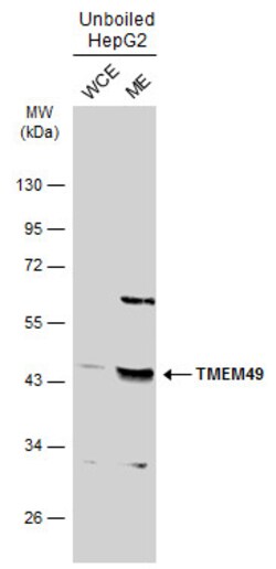 Invitrogen VMP1 Polyclonal Antibody 100 &mu;L; Unconjugated:Antibodies,