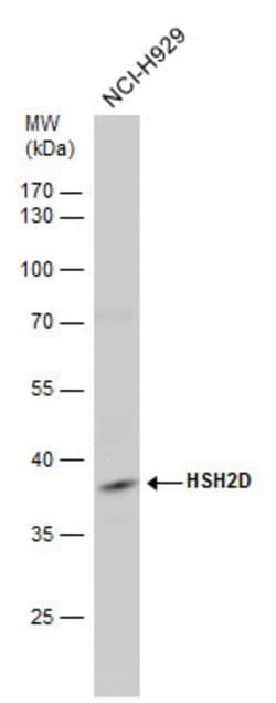 Invitrogen HSH2D Polyclonal Antibody 100 &mu;L | Buy Online | Invitrogen&trade; | Fisher Scientific