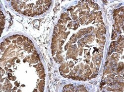 Invitrogen LZTR2 Polyclonal Antibody 100 &mu;L; Unconjugated:Antibodies,