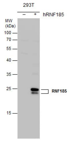 Invitrogen RNF185 Polyclonal Antibody 100 &mu;L; Unconjugated:Antibodies,