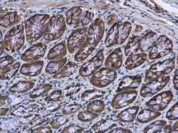 Invitrogen BBS4 Polyclonal Antibody 100 &mu;L; Unconjugated:Antibodies,