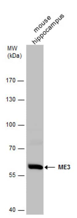 Invitrogen ME3 Polyclonal Antibody 100 &mu;L; Unconjugated:Antibodies,