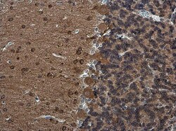 RAP1GAP Polyclonal Antibody, Invitrogen 100 &mu;L; Unconjugated:Antibodies,
