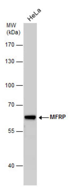Invitrogen MFRP Polyclonal Antibody 100 &mu;L; Unconjugated:Antibodies,