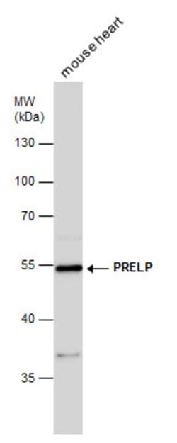 Invitrogen PRELP Polyclonal Antibody 100 &mu;L; Unconjugated:Antibodies,