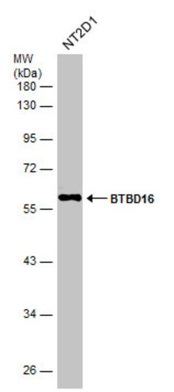 Invitrogen BTBD16 Polyclonal Antibody 100 &mu;L; Unconjugated:Antibodies,