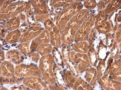 IRAK1BP1 Polyclonal Antibody:Antibodies, Polyclonal