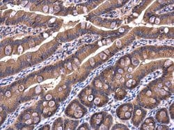 IRAK1BP1 Polyclonal Antibody:Antibodies, Polyclonal