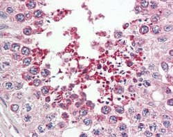 IRAK1BP1 Polyclonal Antibody:Antibodies, Polyclonal