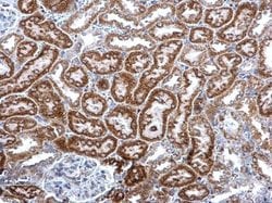Invitrogen PABPC5 Polyclonal Antibody 100 &mu;L; Unconjugated:Antibodies,