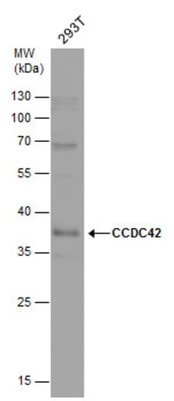 Invitrogen CCDC42 Polyclonal Antibody 100 &mu;L; Unconjugated:Antibodies,