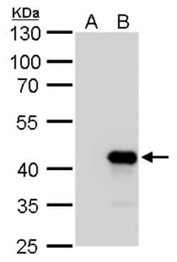Invitrogen Nkx2.3 Polyclonal Antibody 100 &mu;L; Unconjugated:Antibodies,