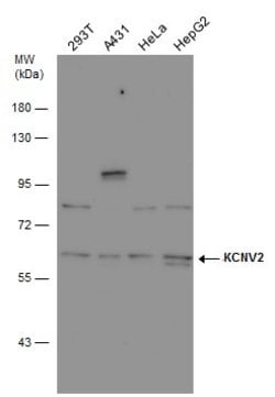 Invitrogen KCNV2 Polyclonal Antibody 100 &mu;L; Unconjugated:Antibodies,
