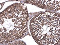 Invitrogen DHX36 Polyclonal Antibody 100 &mu;L; Unconjugated:Antibodies,