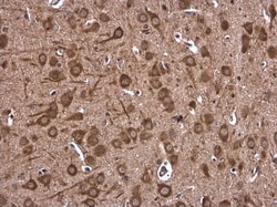 Invitrogen DHX36 Polyclonal Antibody 100 &mu;L; Unconjugated:Antibodies,