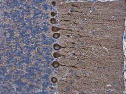 Invitrogen SHANK2 Polyclonal Antibody 100 &mu;L; Unconjugated:Antibodies,