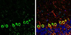 Invitrogen SAPAP1 Polyclonal Antibody 100 &mu;L; Unconjugated:Antibodies,