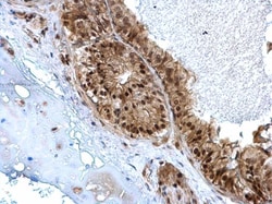 Invitrogen ZBTB5 Polyclonal Antibody 100 &mu;L; Unconjugated:Antibodies,
