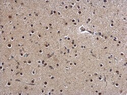 Invitrogen ZBTB5 Polyclonal Antibody 100 &mu;L; Unconjugated:Antibodies,