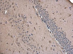 Invitrogen ABAT Polyclonal Antibody 100 &mu;L; Unconjugated:Antibodies,