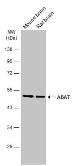 Invitrogen ABAT Polyclonal Antibody 100 &mu;L; Unconjugated:Antibodies,