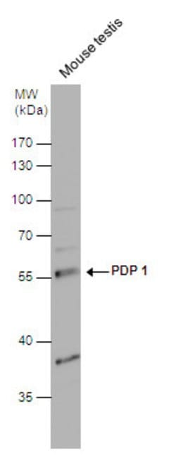 Invitrogen PDP1 Polyclonal Antibody 100 &mu;L; Unconjugated:Antibodies,