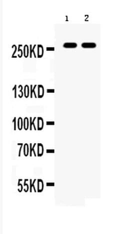 Invitrogen ABCA4 Polyclonal Antibody 100 &mu;g; Unconjugated:Antibodies,