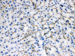 Invitrogen BSEP Polyclonal Antibody 100 &mu;g; Unconjugated:Antibodies,
