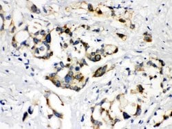Invitrogen BSEP Polyclonal Antibody 100 &mu;g; Unconjugated:Antibodies,