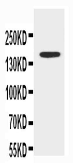 Invitrogen ABCB4 Polyclonal Antibody 100 &mu;g; Unconjugated:Antibodies,