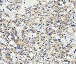 Invitrogen&trade;&nbsp;ABCB4 Polyclonal Antibody