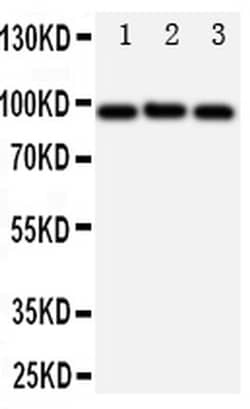 Invitrogen ABCB6 Polyclonal Antibody 100 &mu;g; Unconjugated:Antibodies,