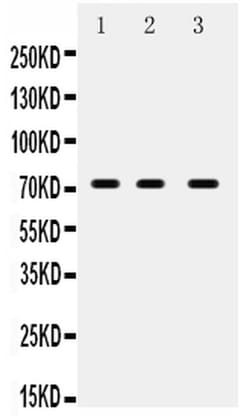 Invitrogen ABCG5 Polyclonal Antibody 100 &mu;g; Unconjugated:Antibodies,