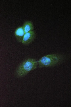 Invitrogen&trade;&nbsp;ABHD5 Polyclonal Antibody
