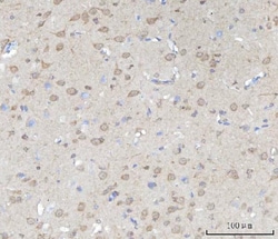 Invitrogen ABI1 Polyclonal Antibody 100 &mu;g; Unconjugated:Antibodies,