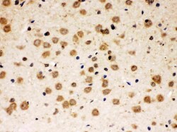 Invitrogen ABR Polyclonal Antibody 100 &mu;g; Unconjugated:Antibodies,