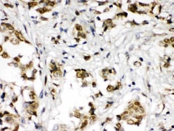 Invitrogen ABR Polyclonal Antibody 100 &mu;g; Unconjugated:Antibodies,