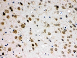 Invitrogen ABR Polyclonal Antibody 100 &mu;g; Unconjugated:Antibodies,
