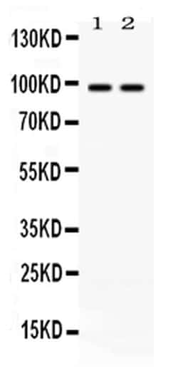 Invitrogen ABR Polyclonal Antibody 100 &mu;g; Unconjugated:Antibodies,